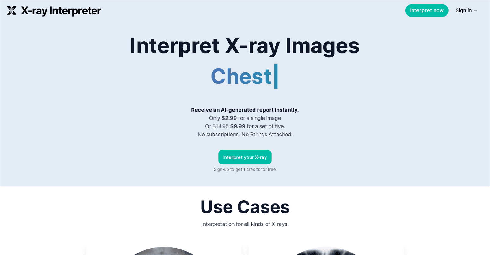 X-ray Interpreter